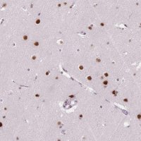 Anti-C2orf82 antibody produced in rabbit 