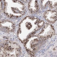 Anti-C3orf38 antibody produced in rabbit 