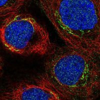 Anti-C3orf67 antibody produced in rabbit 