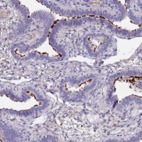 Anti-C3orf80 antibody produced in rabbit 