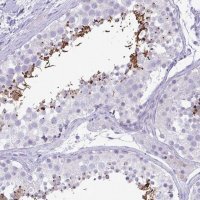 Anti-C4orf33 antibody produced in rabbit