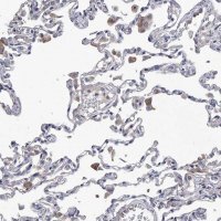 Anti-C5 antibody produced in rabbit