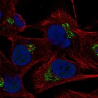 Anti-C5orf15 antibody produced in rabbit 