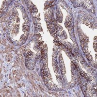 Anti-C6 antibody produced in rabbit 
