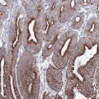Anti-C6orf1 antibody produced in rabbit 