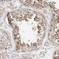 Anti-C6orf118 antibody produced in rabbit 