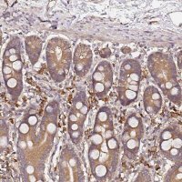 Anti-C6ORF136 antibody produced in rabbit 