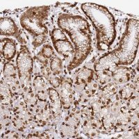 Anti-C6orf141 antibody produced in rabbit 