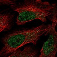 Anti-C7orf25 antibody produced in rabbit HPA049635-100UL