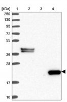 Anti-C8G antibody produced in rabbit 