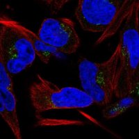 Anti-C9orf64 antibody produced in rabbit HPA066190-100UL