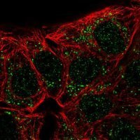 Anti-CA10 antibody produced in rabbit 