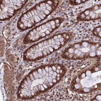 Anti-CABIN1 antibody produced in rabbit 