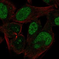 Anti-CABLES1 antibody produced in rabbit 
