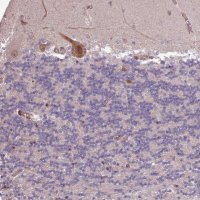 Anti-CABP1 antibody produced in rabbit 