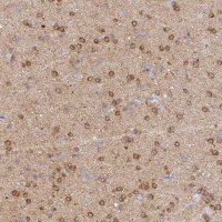 Anti-CACNA1B antibody produced in rabbit 