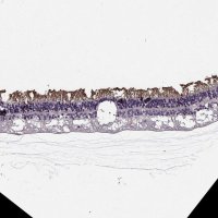 Anti-CACNA1F antibody produced in rabbit 