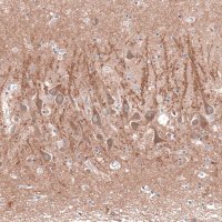 Anti-CACNA1H antibody produced in rabbit 