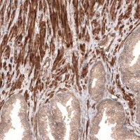 Anti-CACNA1H antibody produced in rabbit 