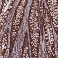 Anti-CACTIN antibody produced in rabbit 