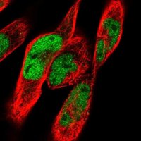 Anti-CACUL1 antibody produced in rabbit 