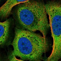 Anti-CACYBP antibody produced in rabbit 