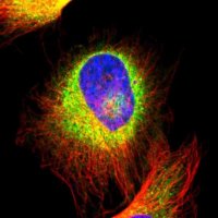 Anti-CALU antibody produced in rabbit 