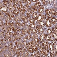 Anti-CAMK1 antibody produced in rabbit 