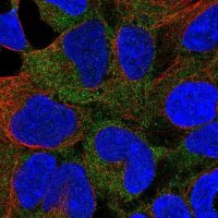 Anti-CAMK1 antibody produced in rabbit 