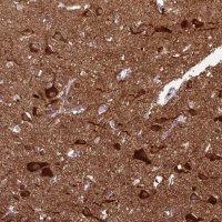 Anti-CAMK2A antibody produced in rabbit