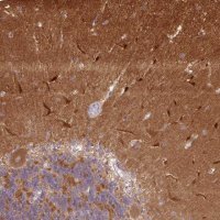 Anti-CAMK2A antibody produced in rabbit