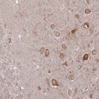 Anti-CAMK2A antibody produced in rabbit HPA051785-100UL