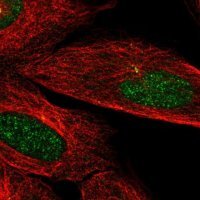 Anti-CAMK2N2 antibody produced in rabbit 