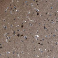 Anti-CAMK4 antibody produced in rabbit 