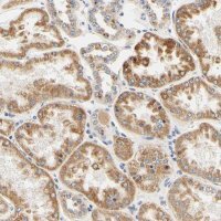 Anti-CAMK4 antibody produced in rabbit HPA011753-100UL