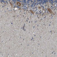 Anti-CAMKK2 antibody produced in rabbit 
