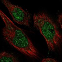 Anti-CAMTA2 antibody produced in rabbit 