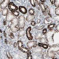 Anti-CAND2 antibody produced in rabbit 