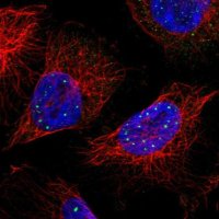 Anti-CAND2 antibody produced in rabbit 