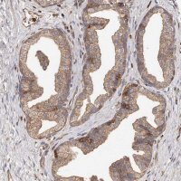 Anti-CAP1 antibody produced in rabbit HPA030124-100UL