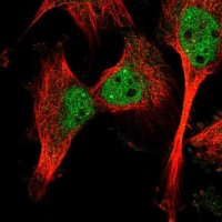 Anti-CAPN10 antibody produced in rabbit 