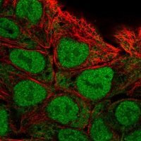 Anti-CAPN13 antibody produced in rabbit 