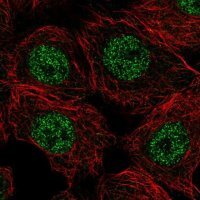 Anti-CAPN15 antibody produced in rabbit