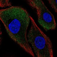 Anti-CAPNS2 antibody produced in rabbit 