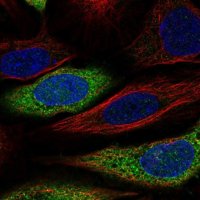 Anti-CAPZA2 antibody produced in rabbit HPA007643-100UL