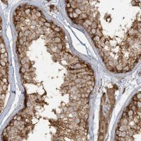 Anti-CAPZB antibody produced in rabbit 