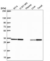 Anti-CAPZB antibody produced in rabbit HPA056066-100UL