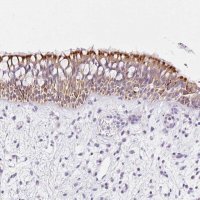 Anti-CARD16 antibody produced in rabbit 
