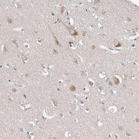 Anti-CARMIL3 antibody produced in rabbit