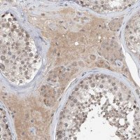 Anti-CARMIL3 antibody produced in rabbit